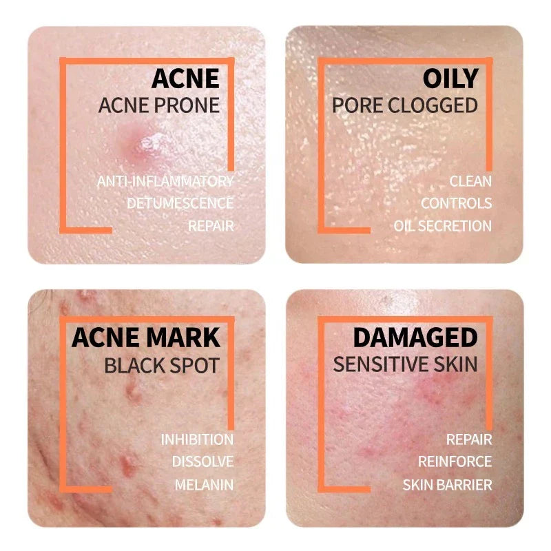 Niacinamide + Glycolic Acid Duo (Solve All Your Skin Problems)