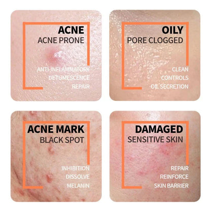 Niacinamide + Glycolic Acid Duo (Solve All Your Skin Problems)