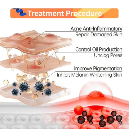 Niacinamide + Glycolic Acid Duo (Solve All Your Skin Problems)