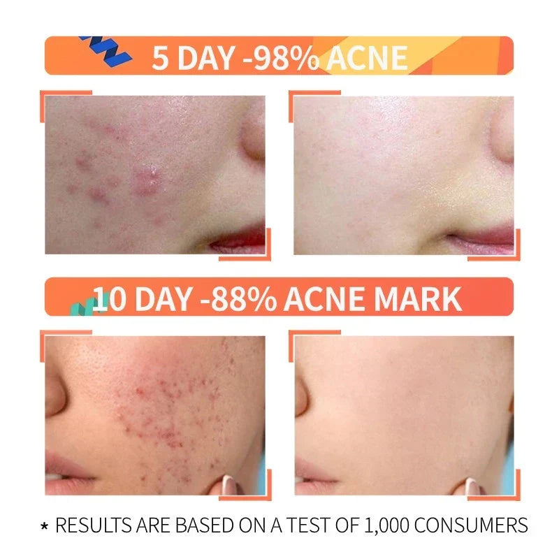 Niacinamide + Glycolic Acid Duo (Solve All Your Skin Problems)