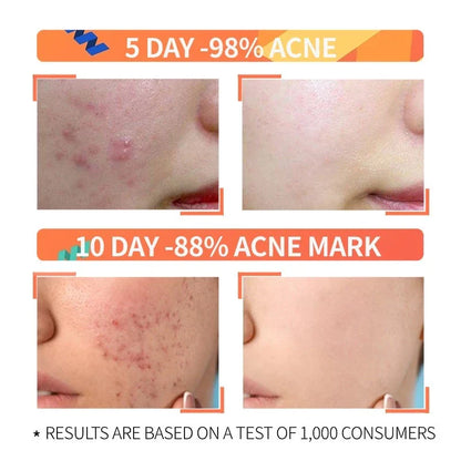 Niacinamide + Glycolic Acid Duo (Solve All Your Skin Problems)