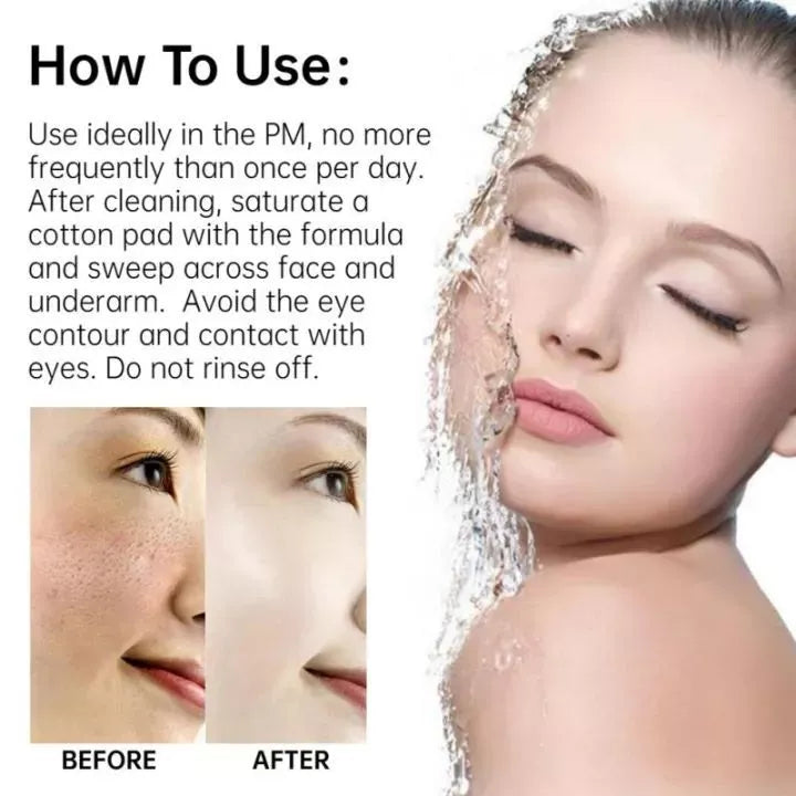 Fade Acne Scars Fast: The Ordinary’s Ultimate Scar-Removal Set for Clearer, Smoother Skin!