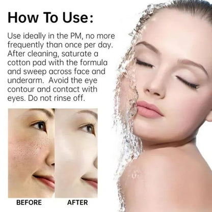 Fade Acne Scars Fast: The Ordinary’s Ultimate Scar-Removal Set for Clearer, Smoother Skin!