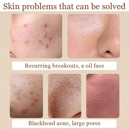 Niacinamide + Glycolic Acid Duo (Solve All Your Skin Problems)